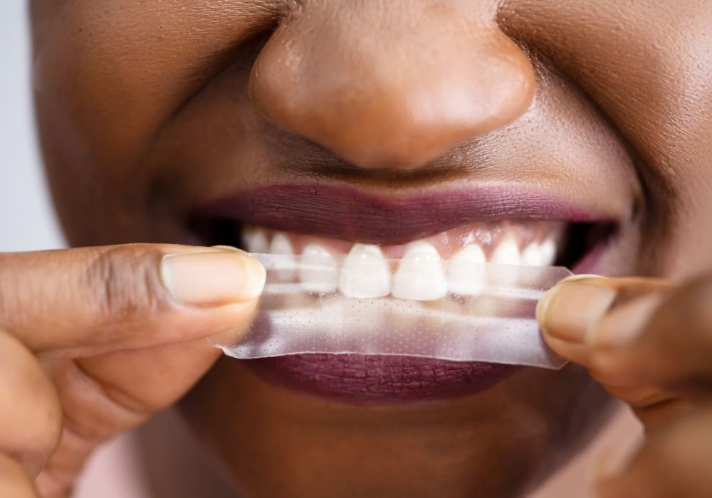 The Impact of Saliva on Teeth Whitening