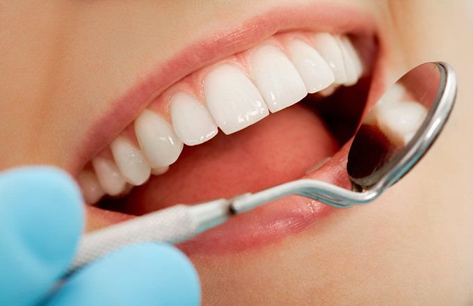 Understanding Dental Insurance Coverage for Teeth Whitening